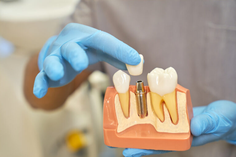 plastic prop teeth implant being shown by dentist