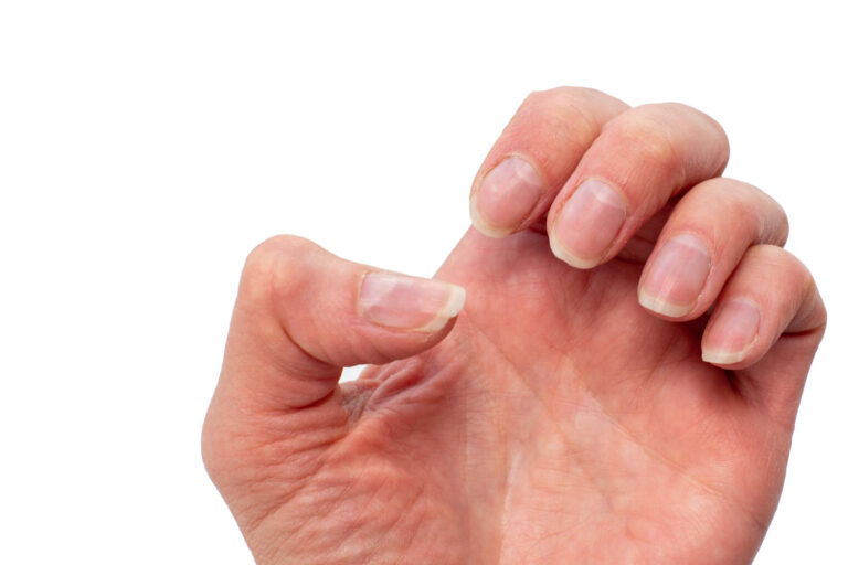 closeup brittle nails female hand white isolated background problematic nails untreated natural nails