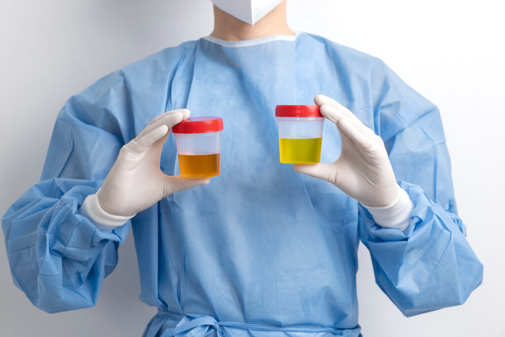 lab doctor performing medical exam urine